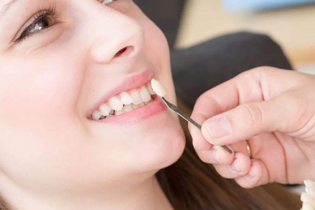 Cosmetic Dentistry Glossary 1 Cosmetic Dentistry Glossary