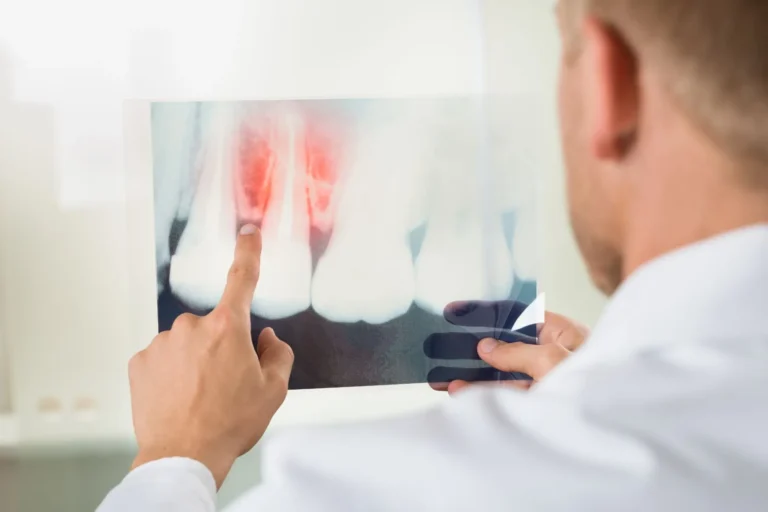 how to cure gum disease without a dentist