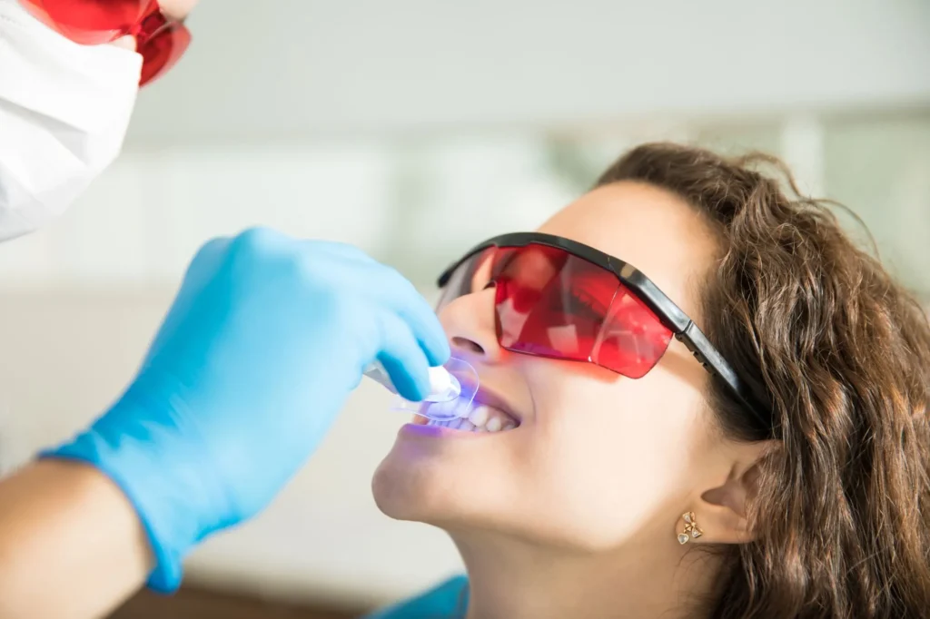 What to Eat After Teeth Whitening