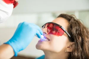 What to Eat After Teeth Whitening