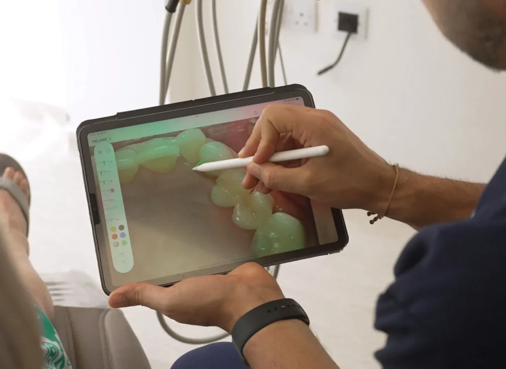 How Long Does a Root Canal Take?